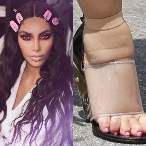 As famosas que são conhecidas por terem os pés mais feios - imagem 120319