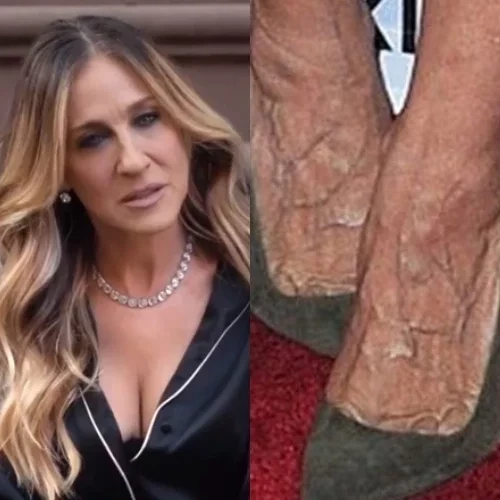 As famosas que são conhecidas por terem os pés mais feios - imagem 120315