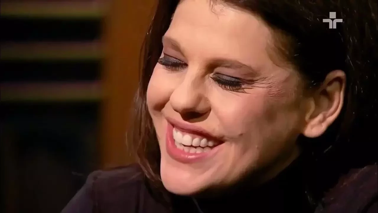 Se surpreenda com as tristes histórias por trás das cicatrizes dos famosos - imagem 127076