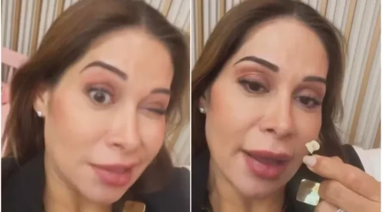 Maíra Cardi perde dente em meio a cuidados com Thiago Nigro: “Não está nem levantando”