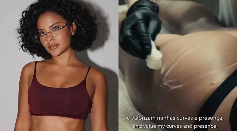 Bella Campos realiza procedimento no bumbum após fim de 'Vale Tudo'
