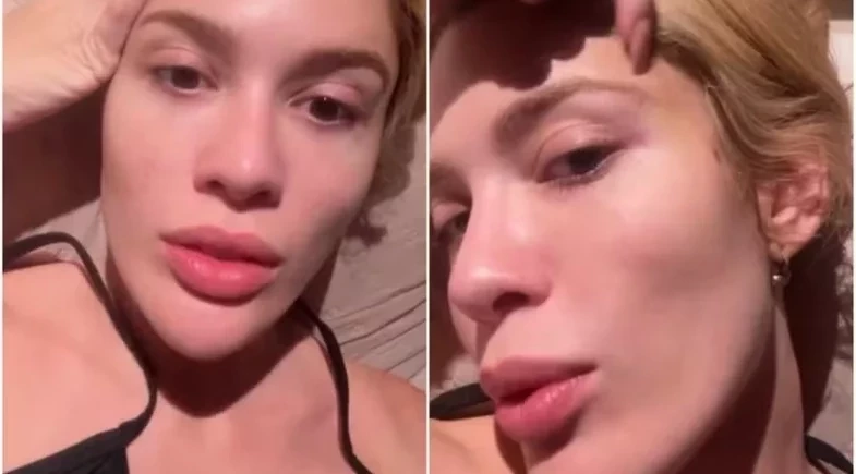 Karoline Lima fala sobre olhos inchados após término: “Sei que estão preocupados”