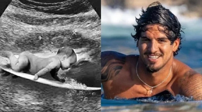 Gabriel Medina cria mistério com postagem de ultrassom e agita seguidores