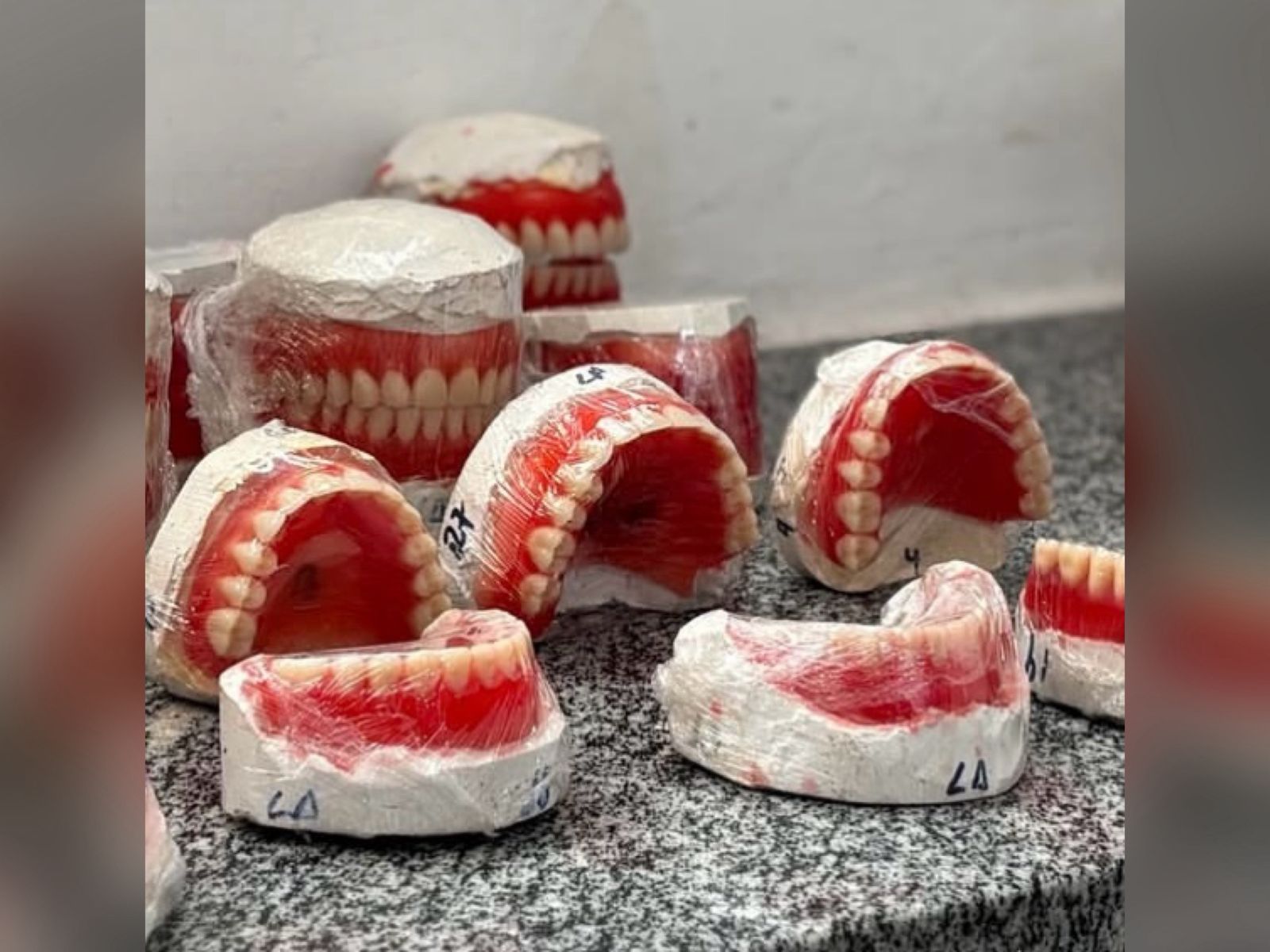 Projeto Prótese Dentária - Foto: Prefeitura de Lagoa Alegre