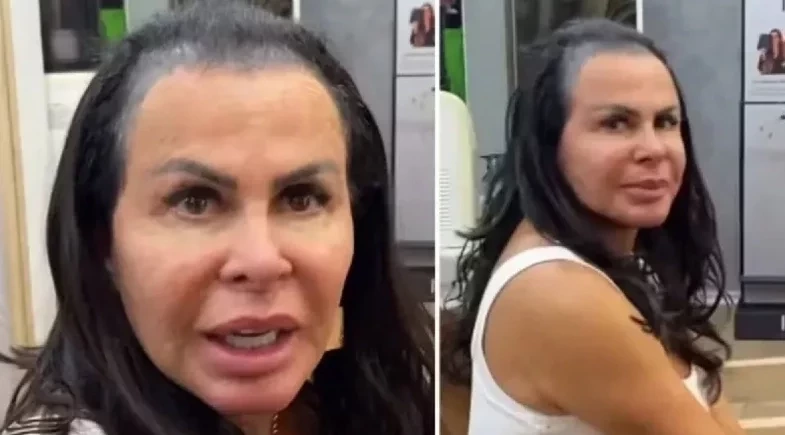 Gretchen revela luta contra alopecia: “Não tenho mais cabelo”