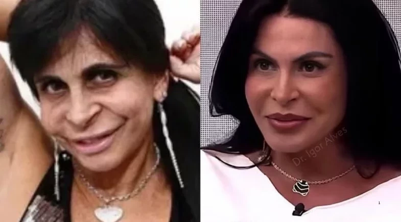 Gretchen surpreende ao mostrar nova transformação no rosto: “Confiança e paciência”