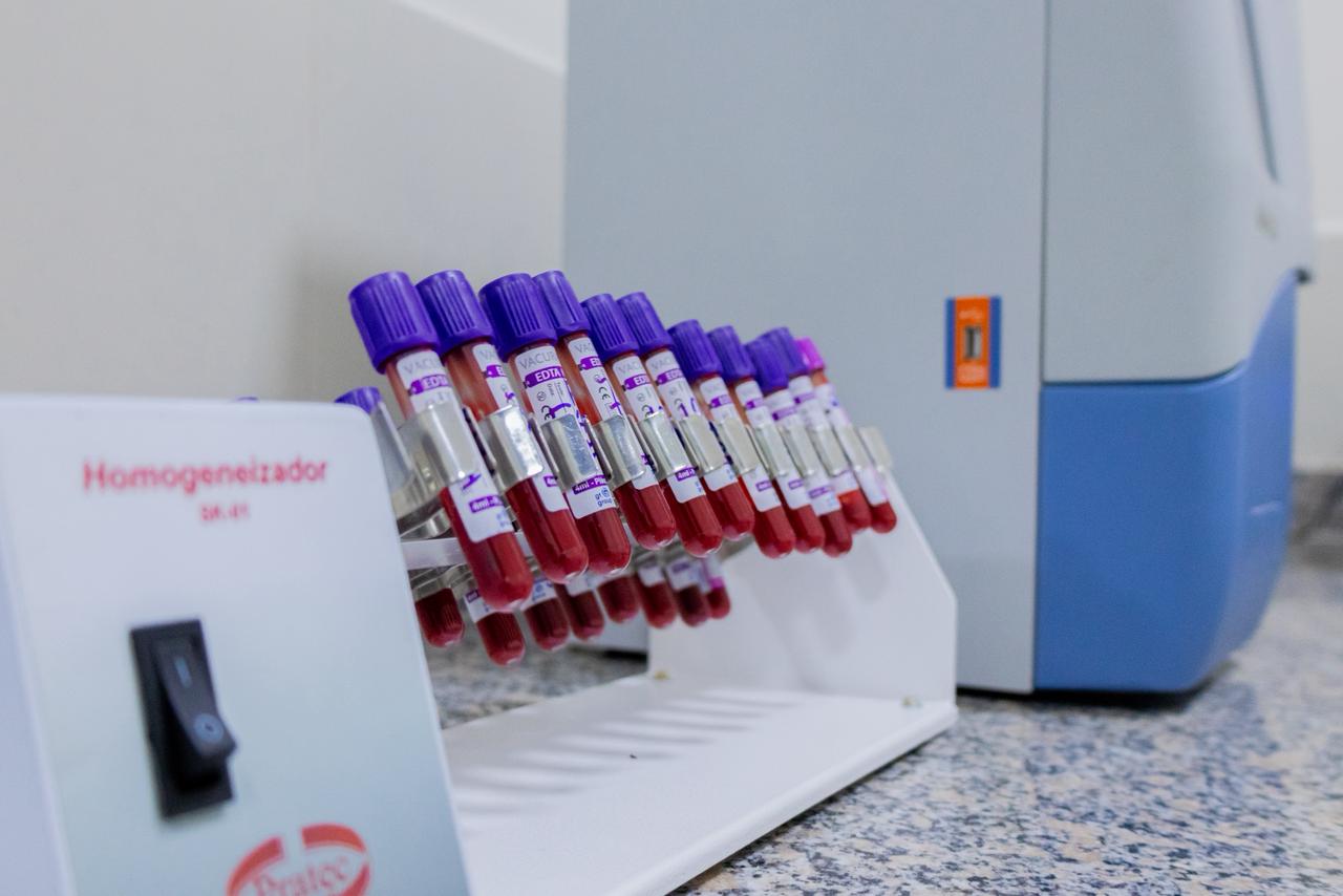 Prefeito Pedro Gomes entrega Raio-X Digital e modernização do Laboratório Municipal em José de Freitas - Imagem 2