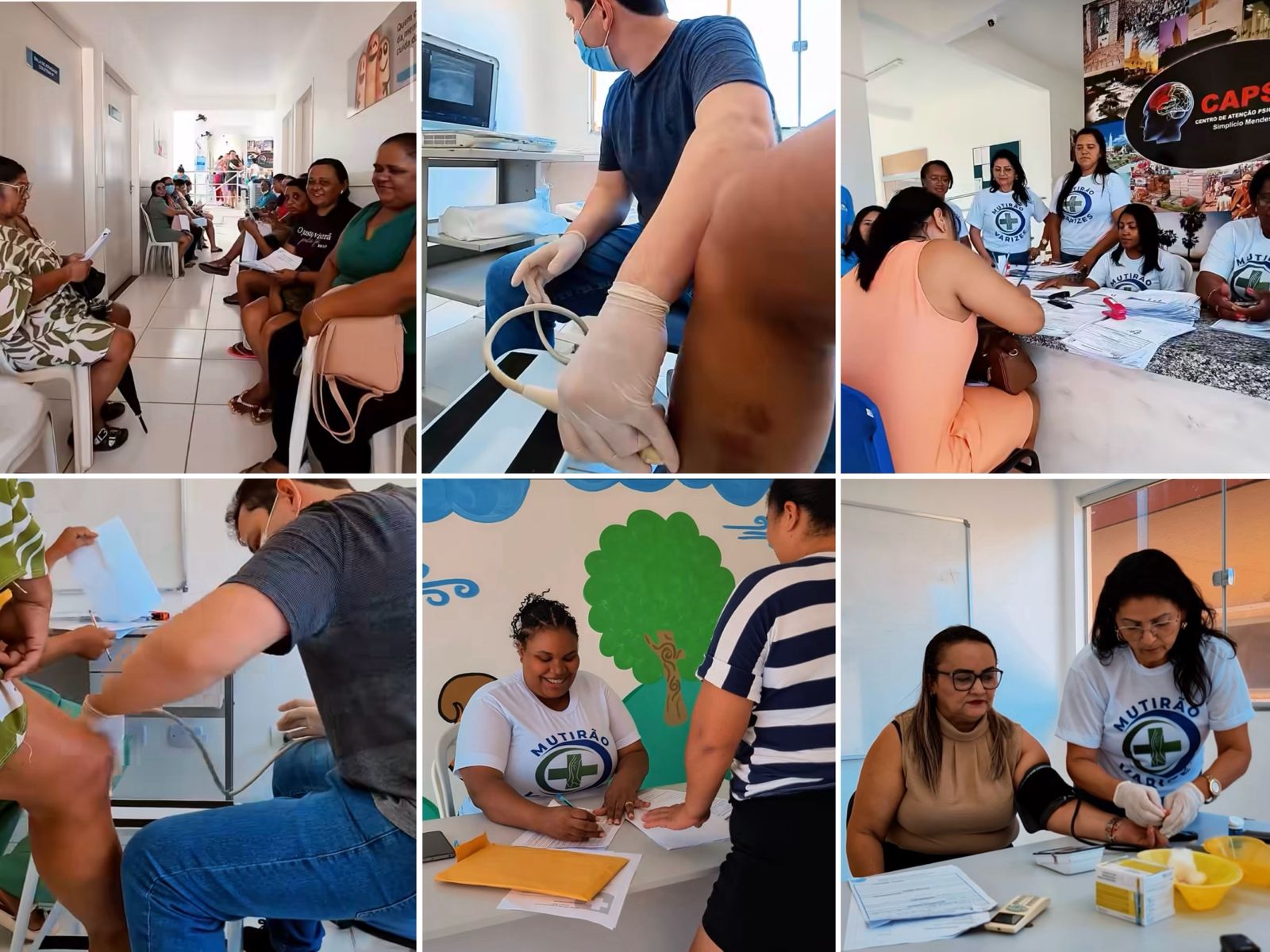 Mutirão de Varizes - Foto: Prefeitura de Simplício Mendes