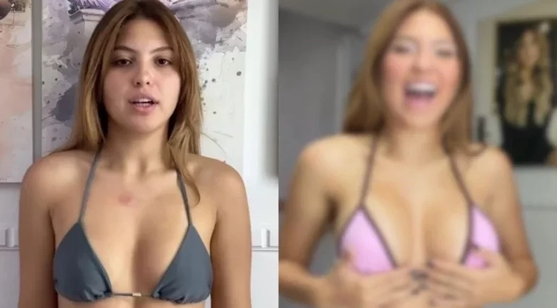 Mari Menezes choca com antes e depois após colocar silicone; veja o resultado!