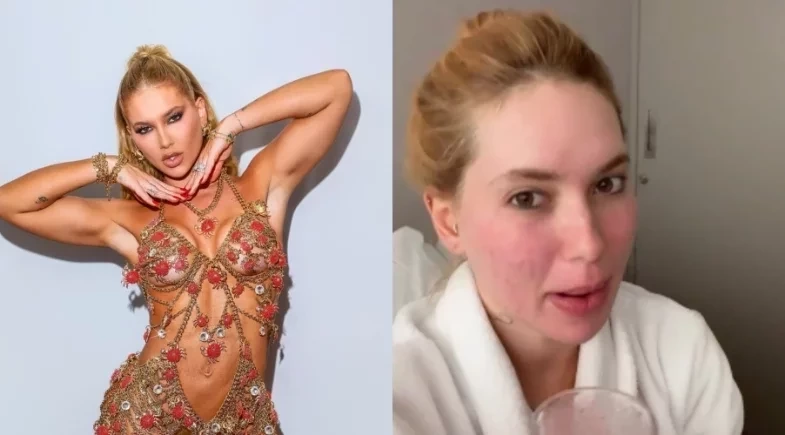 Virginia nega cirurgia e diz ter feito apenas um procedimento a laser: ''Repreendido'' 