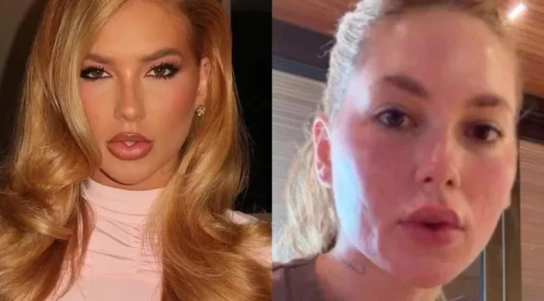 Virginia toma susto com o próprio rosto após tratamento: “Vermelha, não, além”; Veja!