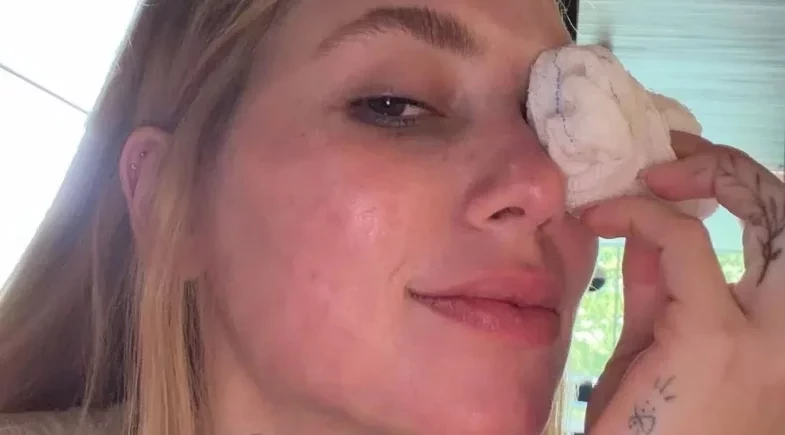 Virginia surge com lesão no olho após acidente com a filha Maria Flor; vídeo!