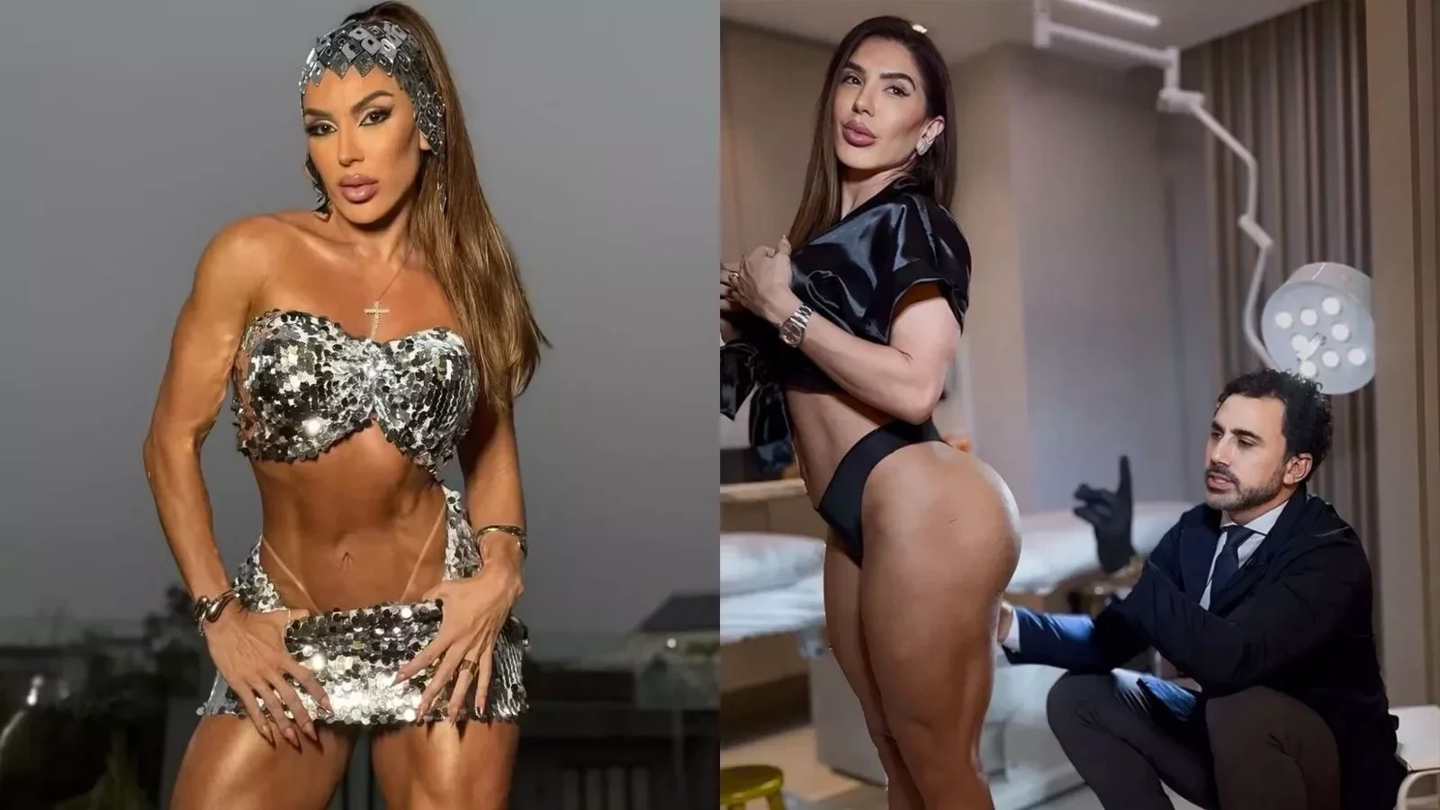 Além de Virginia, conheça famosas que fizeram procedimento no bumbum antes do Carnaval - imagem 136707