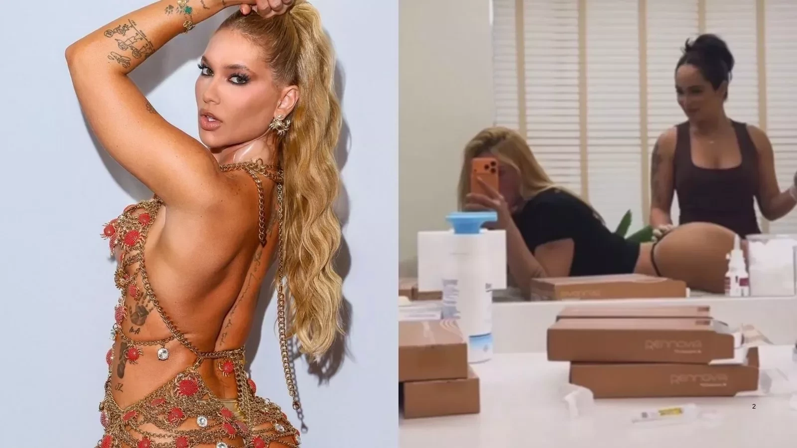 Além de Virginia, conheça famosas que fizeram procedimento no bumbum antes do Carnaval - imagem 136704