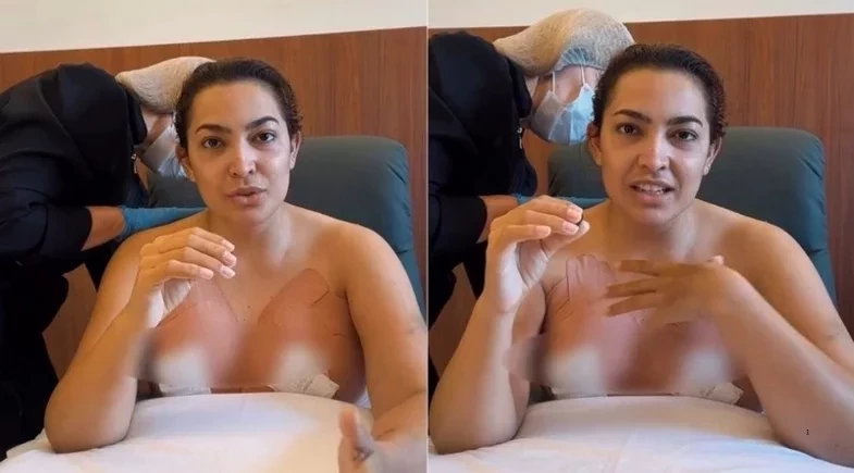 Camila Moura mostra evolução da recuperação após três cirurgias plásticas