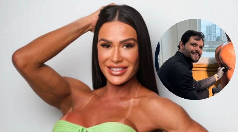 Gracyanne Barbosa mostra resultado de harmonização no bumbum: “Bem melhor”