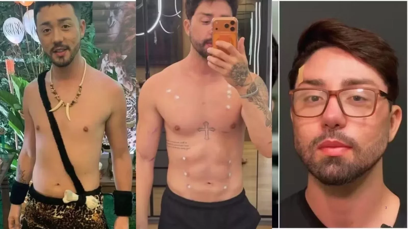 Famosos que deram o que falar com transformações estéticas em 2025 - imagem 137661