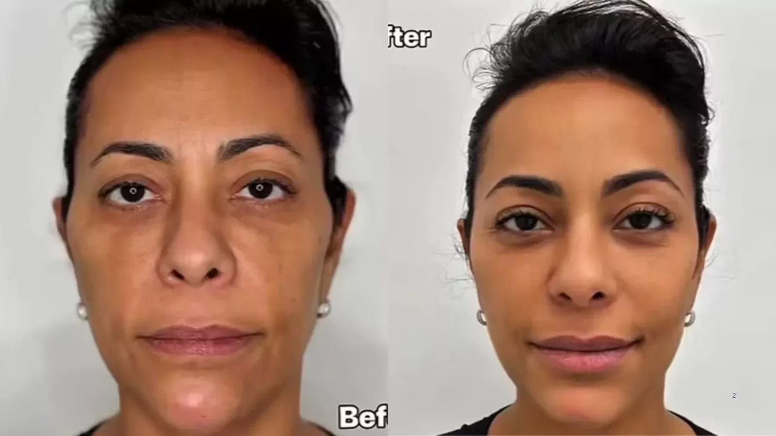 Famosos que deram o que falar com transformações estéticas em 2025 - imagem 137659