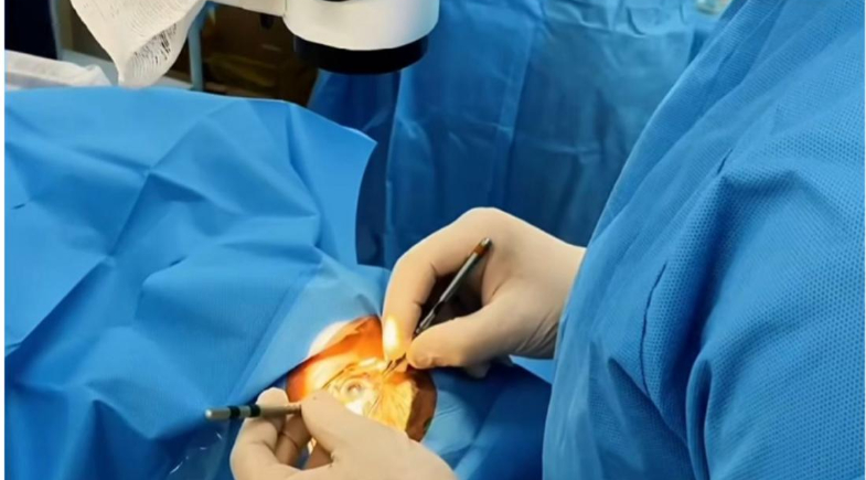 Prefeitura de Simplício Mendes realiza mutirão de cirurgias de catarata no município 