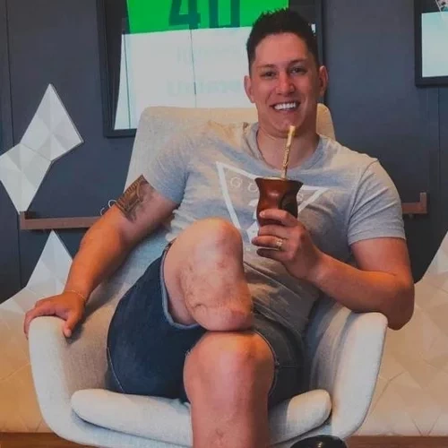 Você sabia que esses famosos não têm uma parte do corpo? - imagem 127900