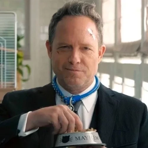 Famosos que perderam partes do corpo e você provavelmente não sabia! - imagem 129316