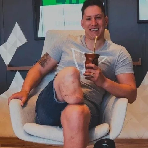 Famosos que perderam partes do corpo e você provavelmente não sabia! - imagem 129315