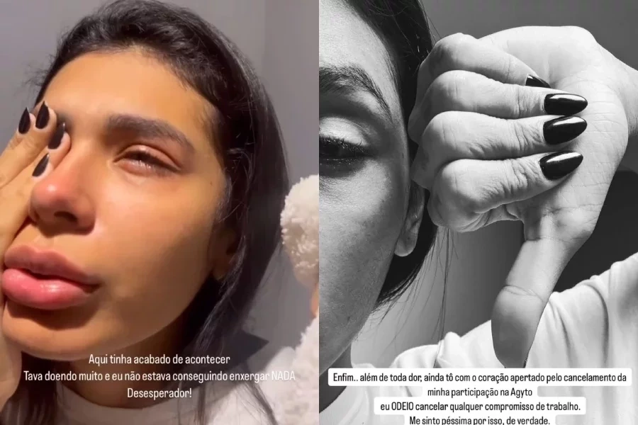 Pocah fere o olho em acidente e precisa cancelar show: “Muita dor”