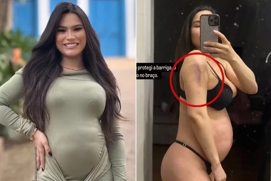 Grávida, Raissa Barbosa cai de escada e vai parar no hospital: “Protegi a barriga”