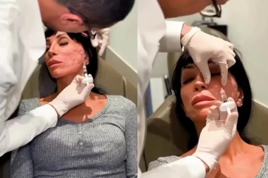 Maya Massafera aplica esperma de salmão no rosto: “Já coloquei tanto”