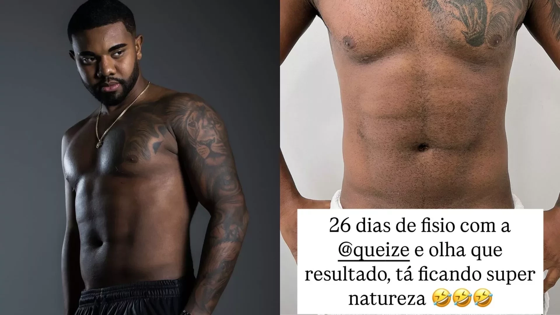 Davi Brito mostra transformação após lipo HD no abdômen