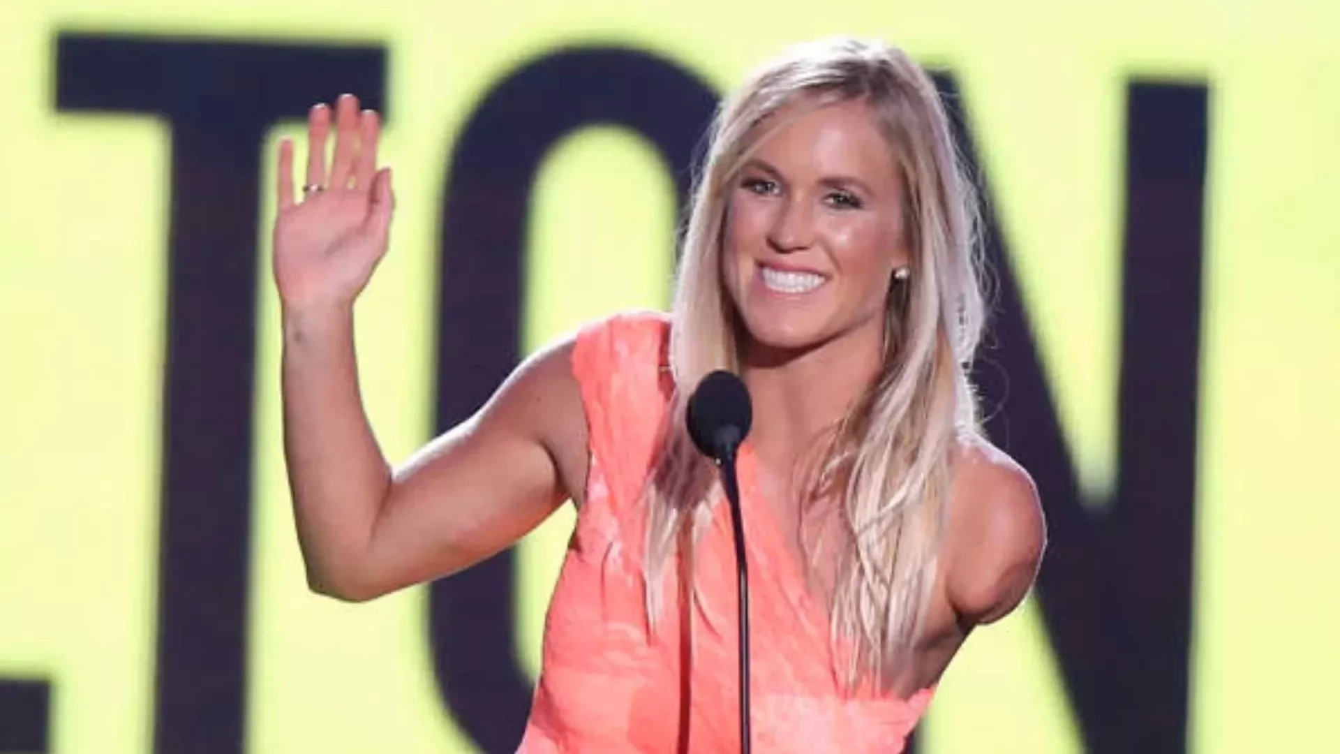 Famosos que são amputados e você provavelmente não sabia - imagem 130555