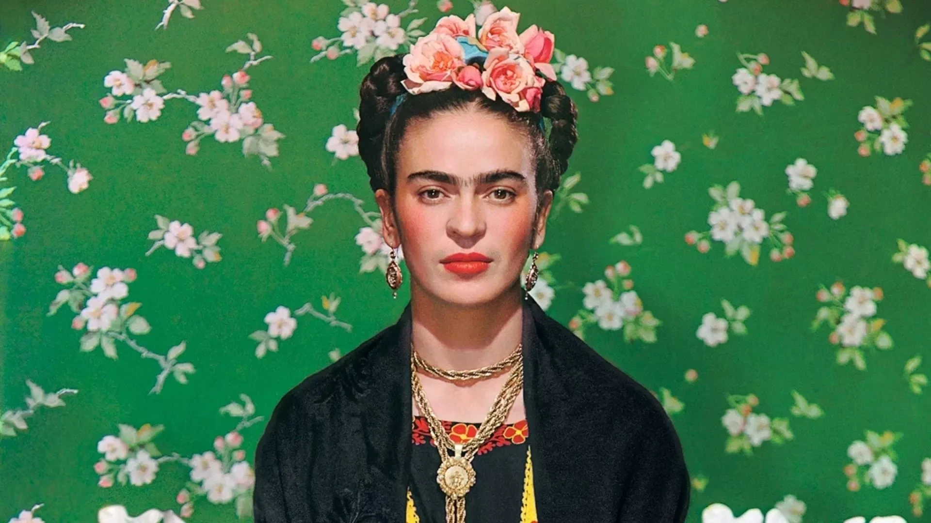 Famosos que são amputados e você provavelmente não sabia - imagem 130549