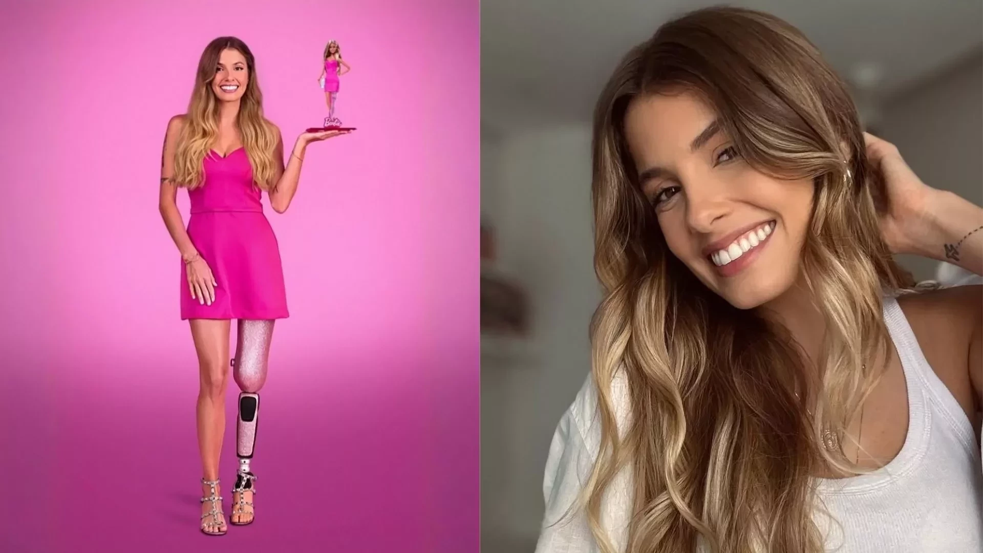 Famosos que são amputados e você provavelmente não sabia - imagem 130553