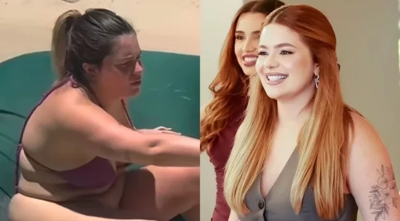 Viih Tube choca com antes e depois após cirurgias plásticas: “Mudei o DNA”