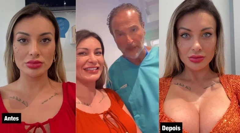 Andressa Urach revela complicações após alterar cor dos olhos na França