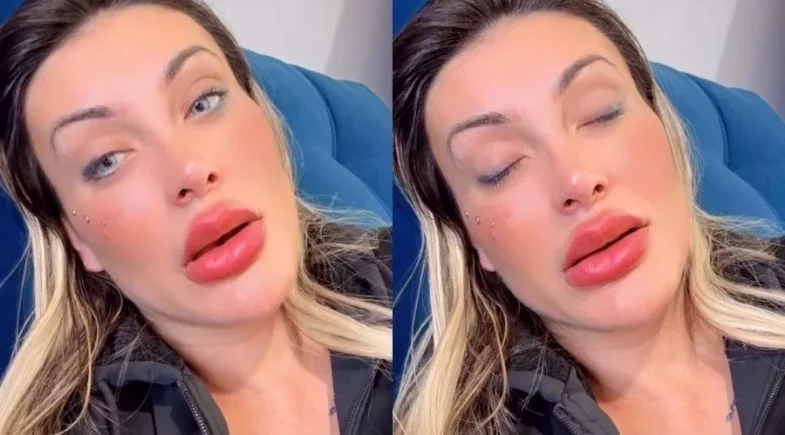 Andressa Urach revela medo de perder a visão após cirurgia no olho; video