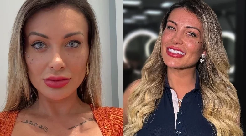 Andressa Urach preocupa fãs ao mostrar rosto sangrando após procedimento