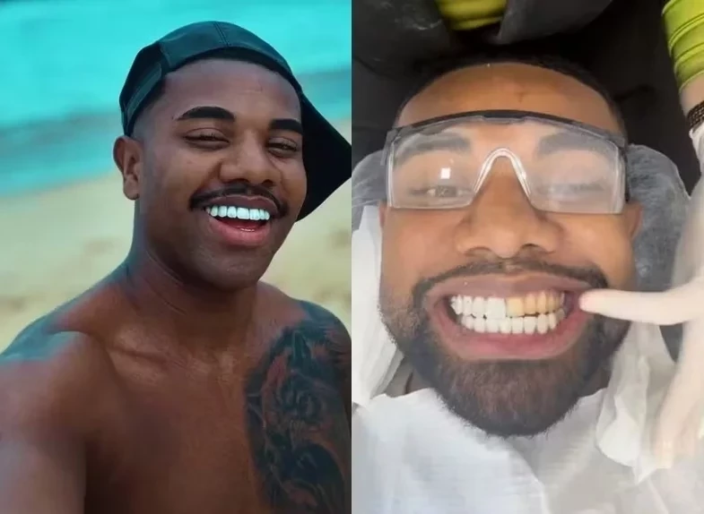 Após críticas, Davi Brito troca lentes de contato dos dentes: “Estava muito grande”
