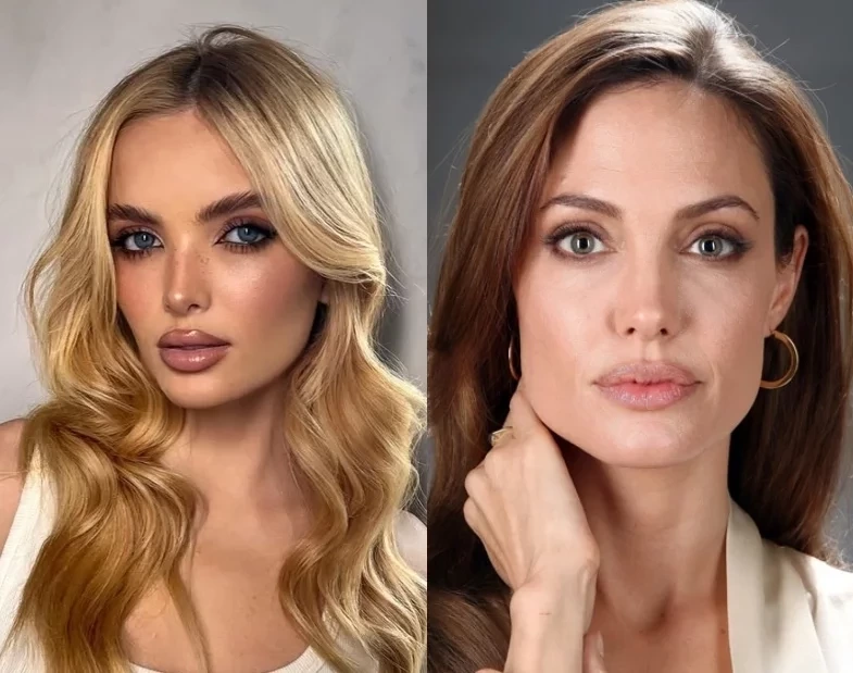 Giovanna Chaves faz harmonização facial para ficar parecida com Angelina Jolie