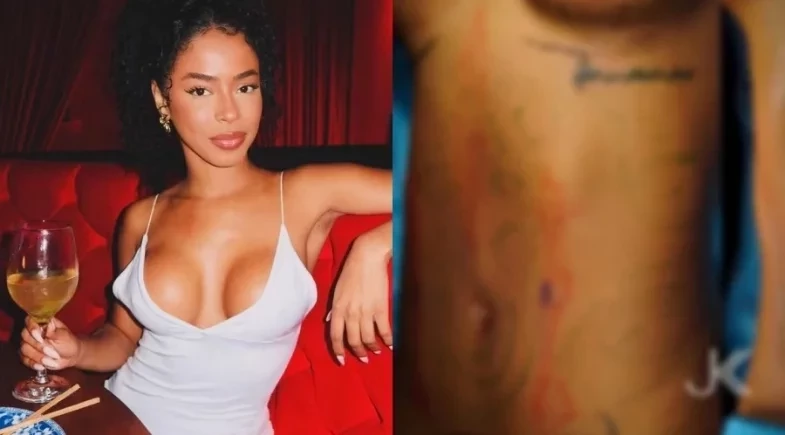 Lorena Maria gasta R$ 160 mil em cirurgias estéticas; veja antes e depois!