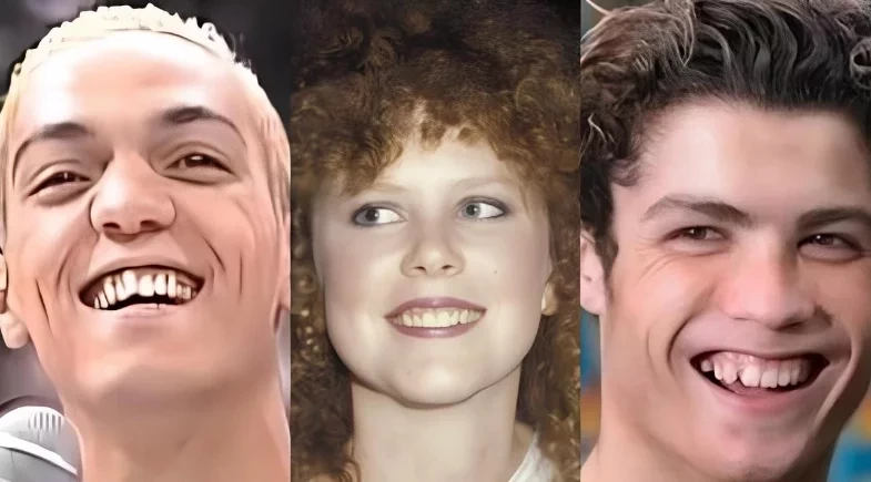 Os sorrisos nada perfeitos das celebridades antes da fama 