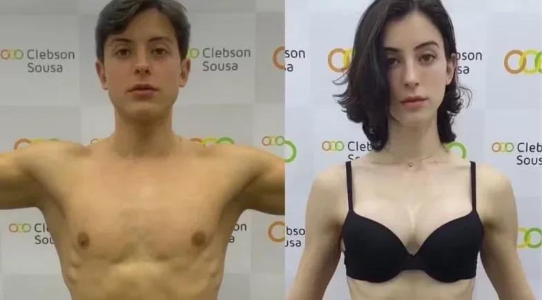 Bella Longuinho compartilha antes e depois da transição: “Nova fase, nova energia”