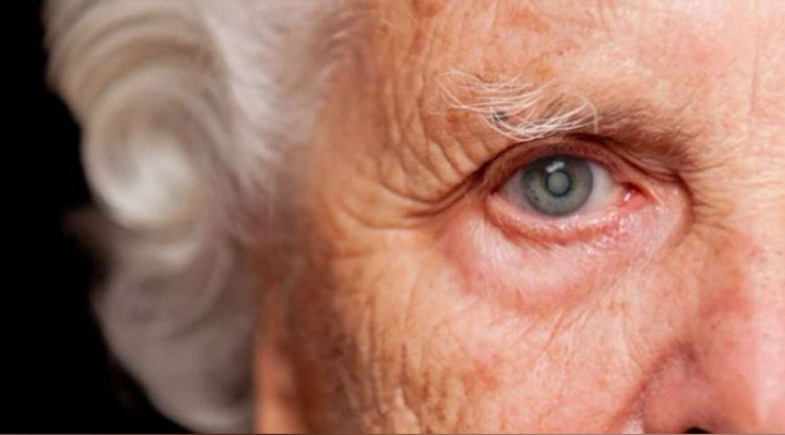 Prefeitura de Simplício Mendes promoverá Mutirão de Cirurgias de Catarata