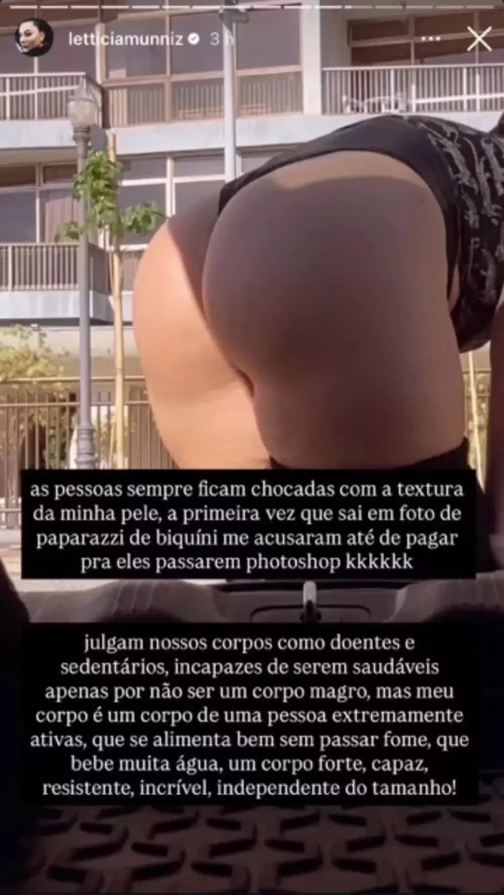 Letticia Munniz desabafa ao exibir bumbum: ''Julgam nossos corpos como doentes'' - imagem 134205