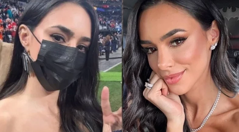 Bruna Biancardi faz alerta a seguidores após ter boca deformada por espremer espinha