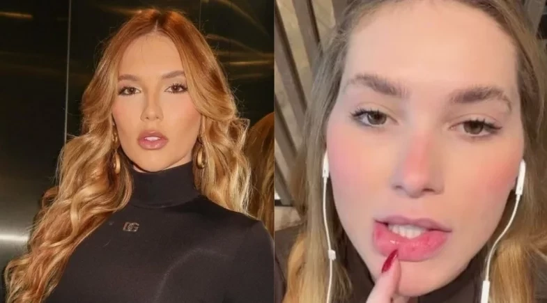 Virginia Fonseca aparece com lábios machucados e chama atenção nas redes