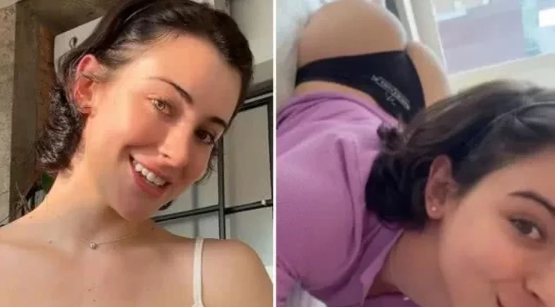 Bella Longuinho mostra antes e depois de procedimento no bumbum