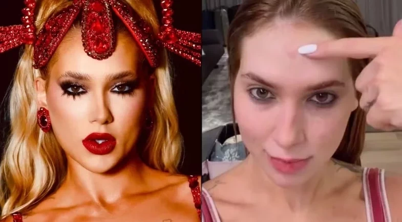 Virginia Fonseca mostra calombo na testa após ensaio da Grande Rio