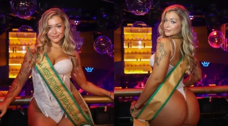  Miss Bumbum 2026 conta como descobriu lipedema durante preparação para concurso