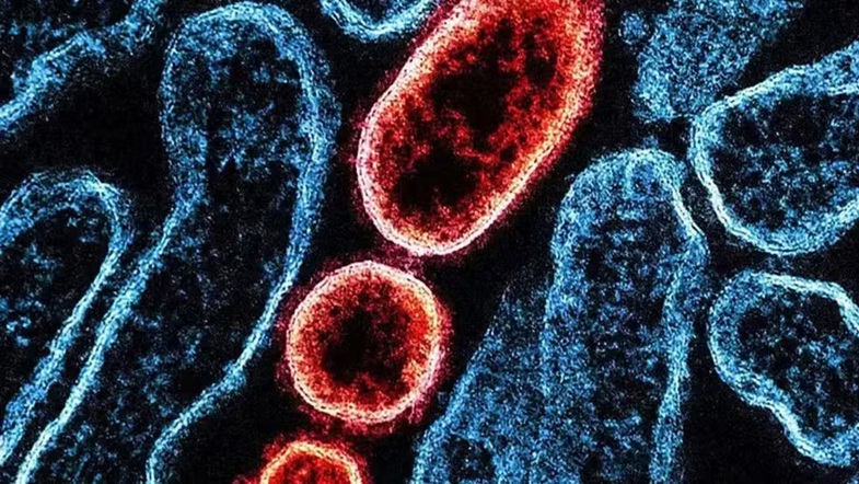 Nipah no Carnaval? Entenda se há risco para o Brasil e quais os sintomas da doença